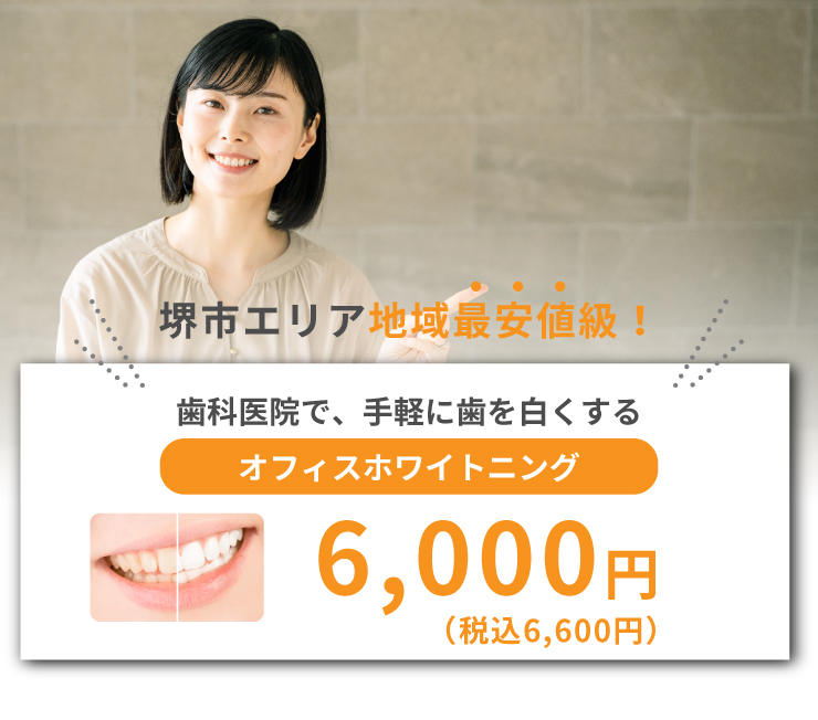 歯科医院でできる、手軽に歯を白くするオフィスホワイトニング税込6,600円