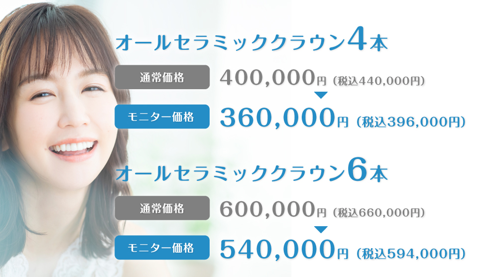 オールセラミッククラウンモニター価格 4本-税込396,000円 6本-税込561,000円